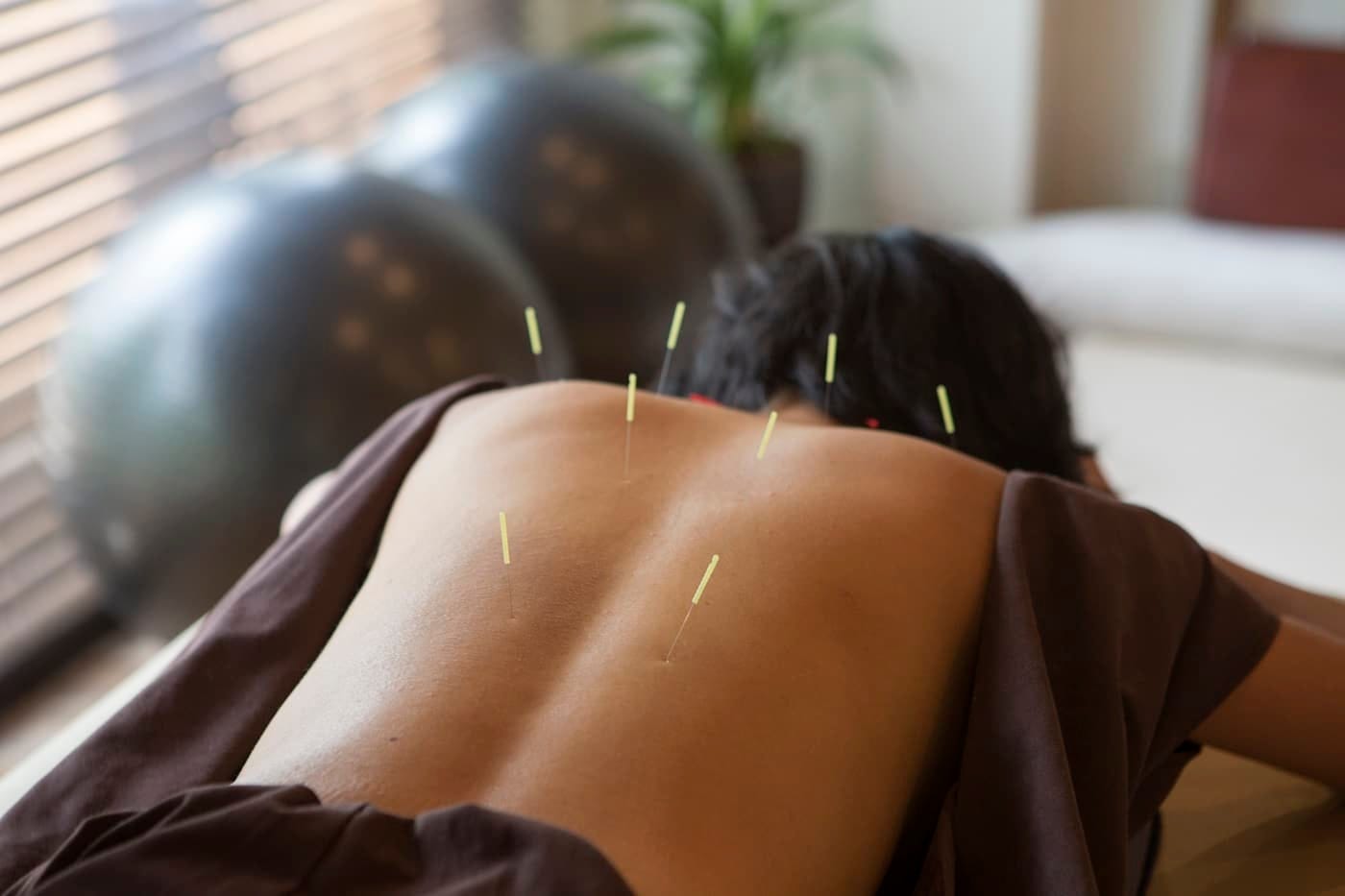 Here Are Some of the Best Ways Acupuncture Can Help Your Brain