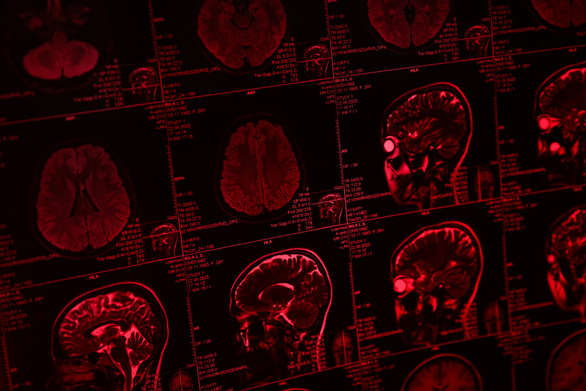 Infrared Brain Light Cap: Why You Need Red Light Therapy! | BrainMD ...