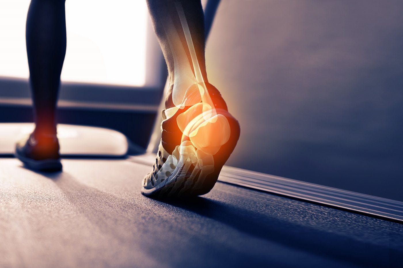 What to Do If You Have Plantar Fasciitis
