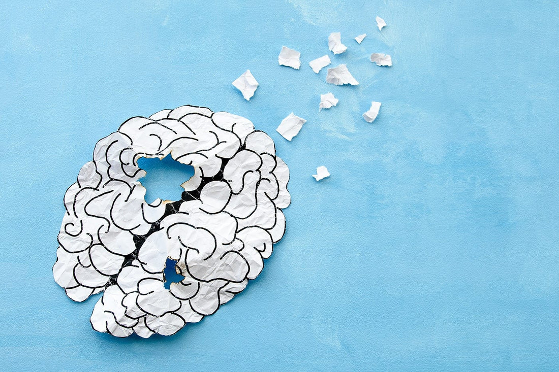 Here Are 7 of the Best Ways to Prevent Brain Atrophy!