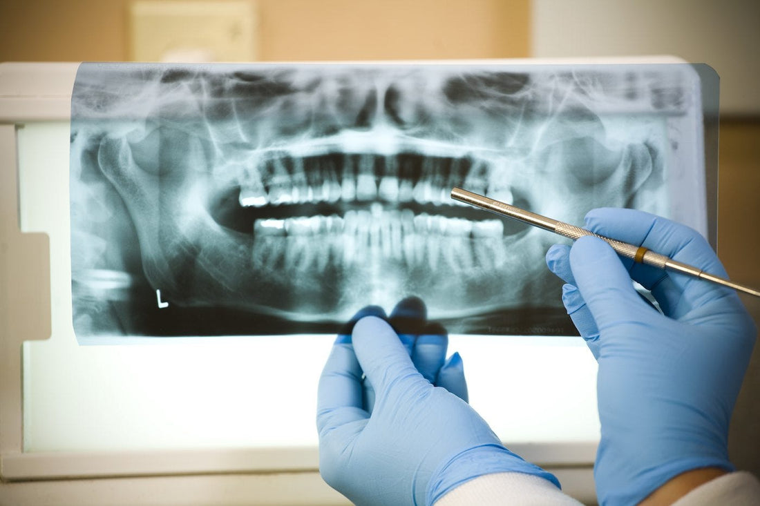 What You Should Know Before You Get a Root Canal