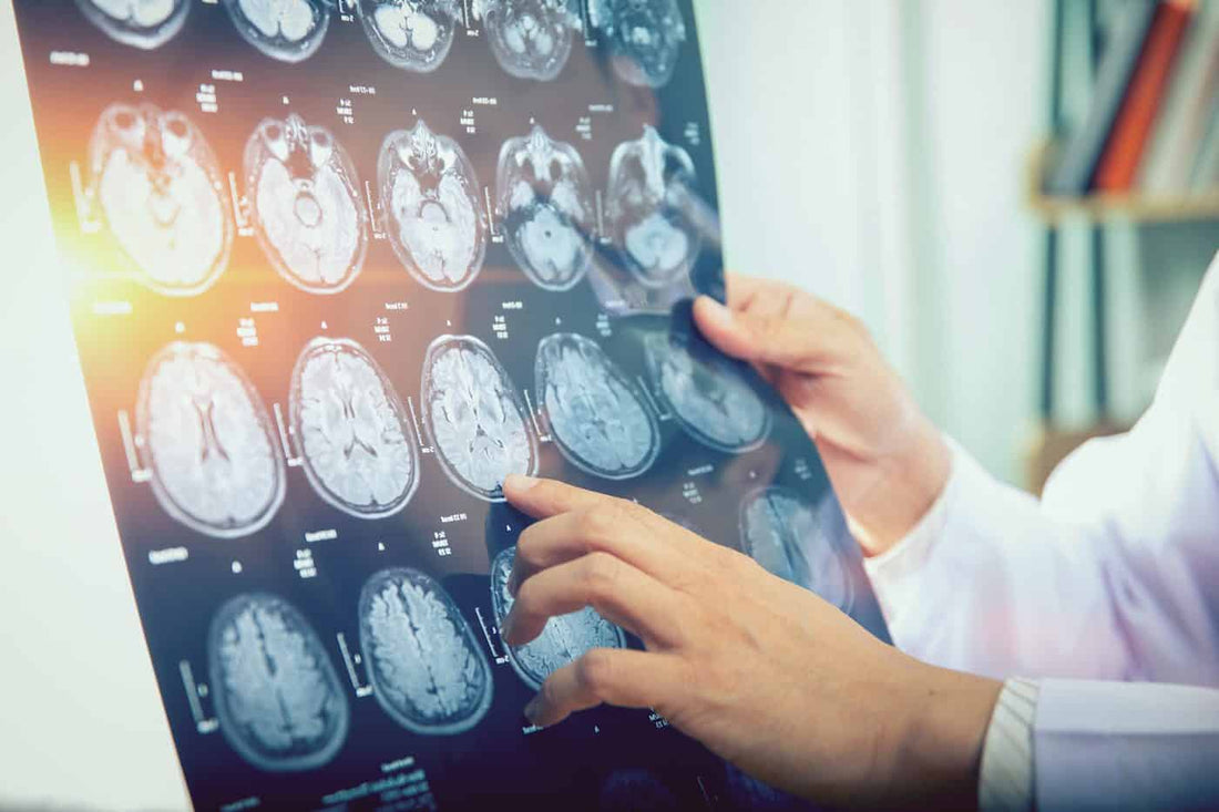 What You Need to Know About Brain Aging