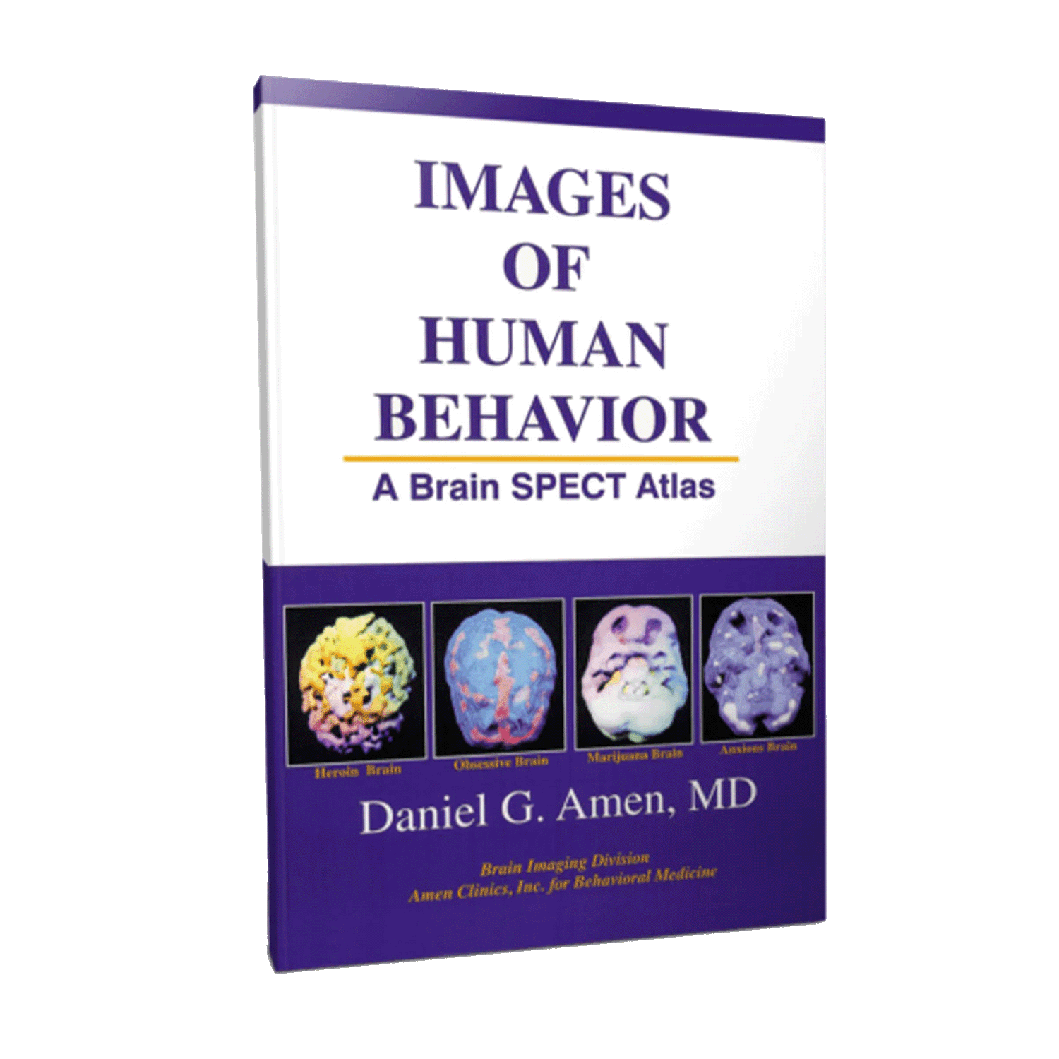 Images of Human Behavior - A Brain SPECT Atlas | BrainMD
