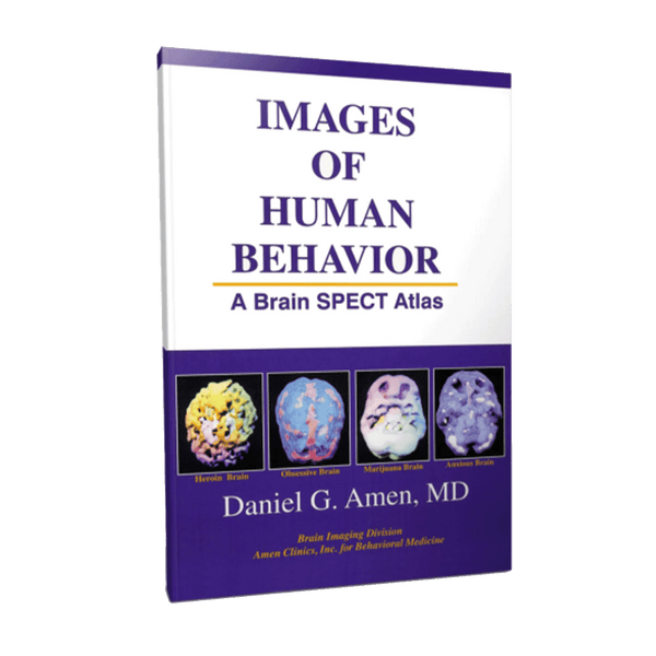 Images of Human Behavior - A Brain SPECT Atlas | BrainMD