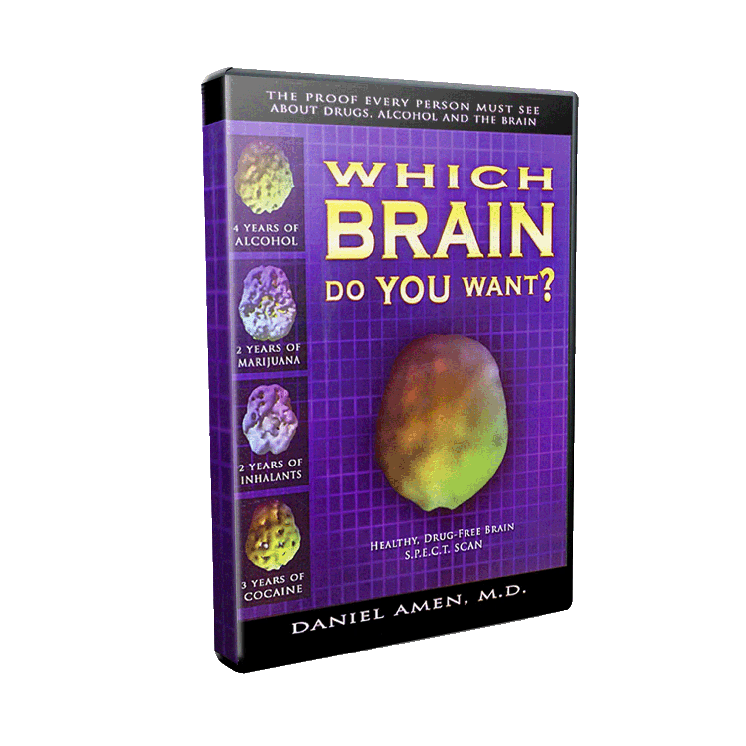 [DVD] Which Brain Do You Want?