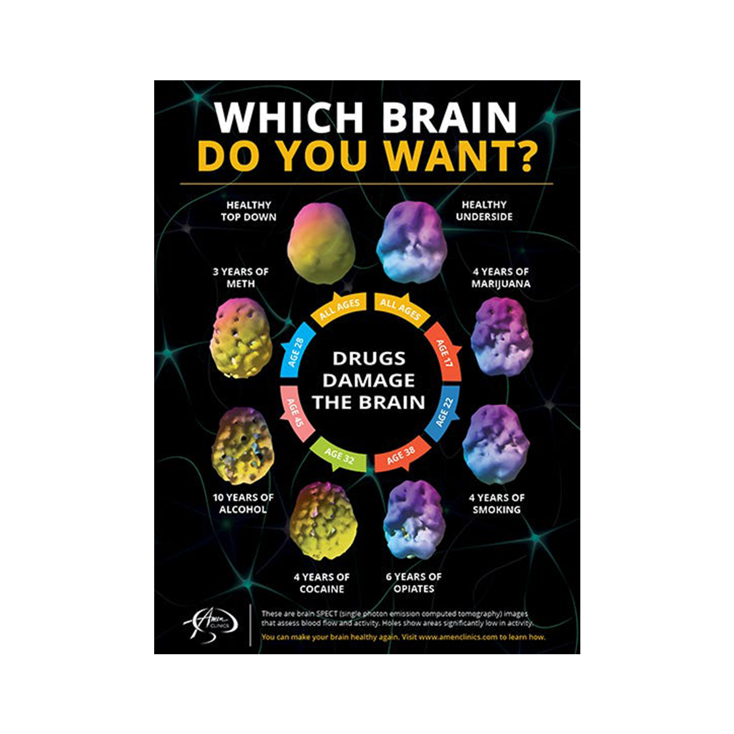 Brain Health Books and Media | BrainMD