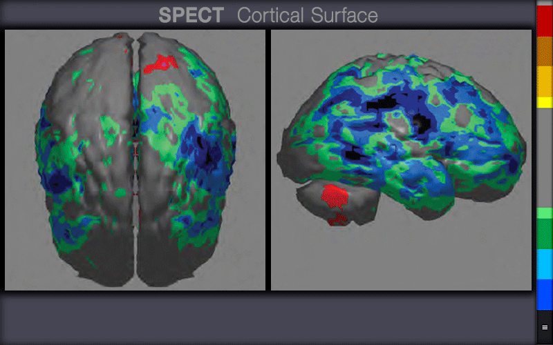 Infrared Brain Light Cap
